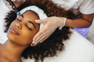 Peelling facial en Querétaro